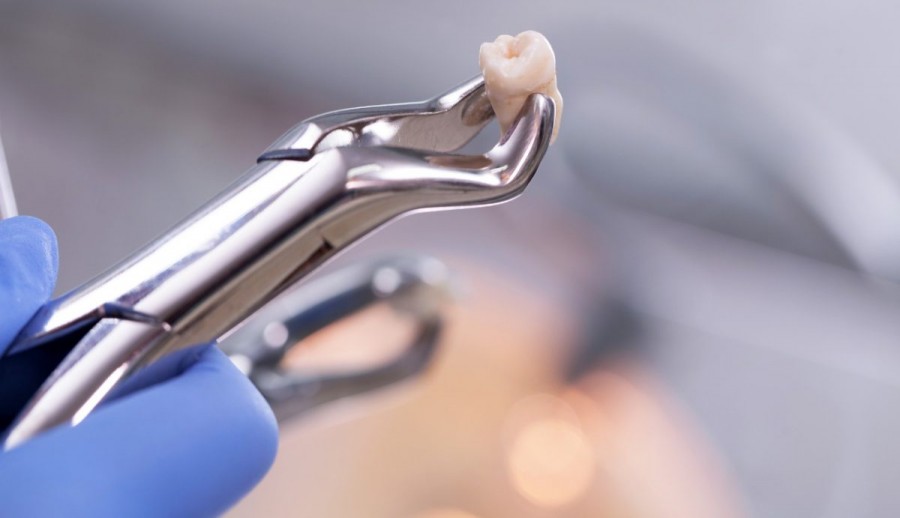 Paciente comprova sequelas aps extrao de dente e receber por dano moral, material e esttico