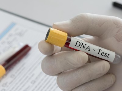 Nome do pai permanece no RG dos filhos, mesmo aps DNA negativo