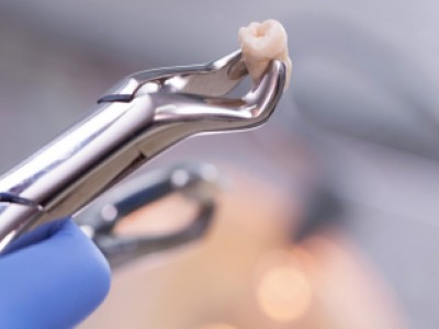 Paciente comprova sequelas aps extrao de dente e receber por dano moral, material e esttico