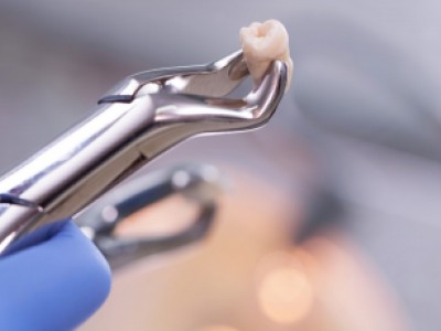 Paciente comprova sequelas aps extrao de dente e receber por dano moral, material e esttico